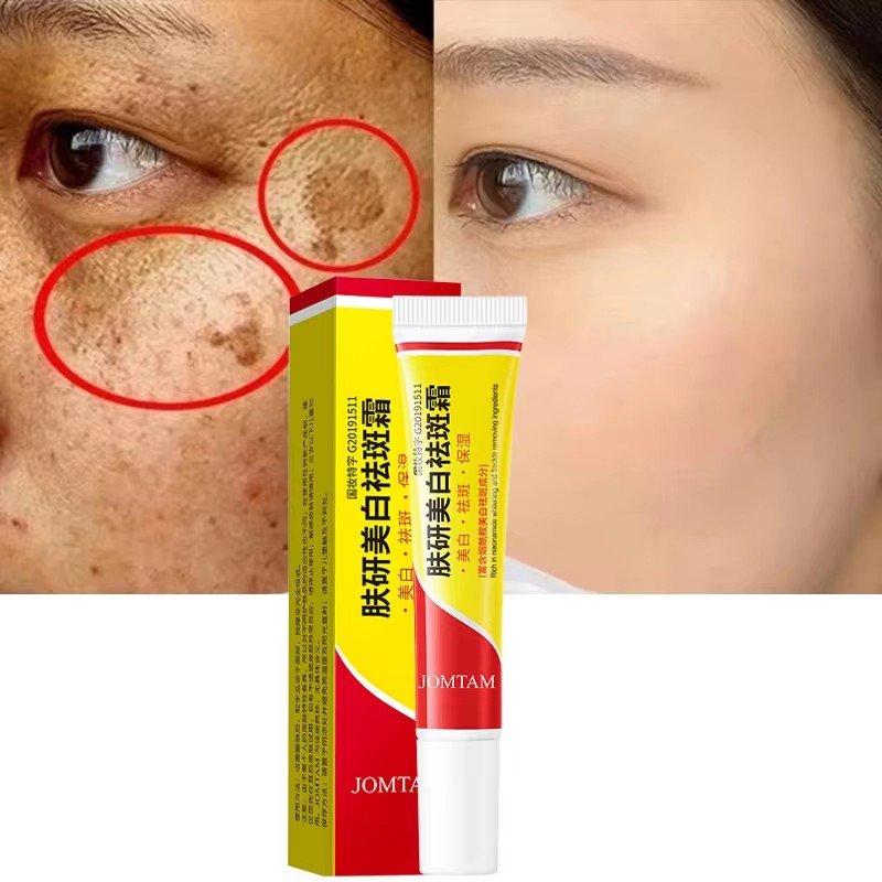 Skincare Glad2Glow - Creme clareador de sardas, creme iluminador