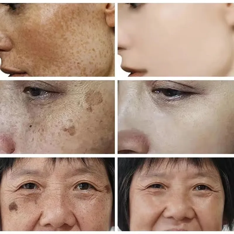 Creme clareador de sardas, cre - Skincare Glad2Glow avaliação e preço