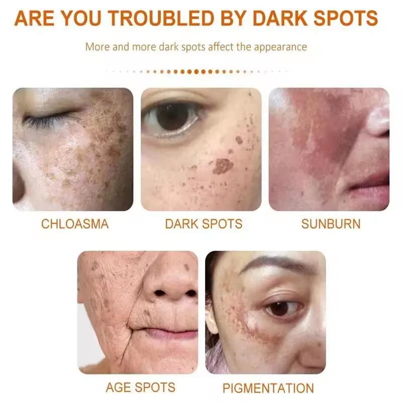 Creme clareador de sardas, cre - Skincare Glad2Glow avaliação e preço