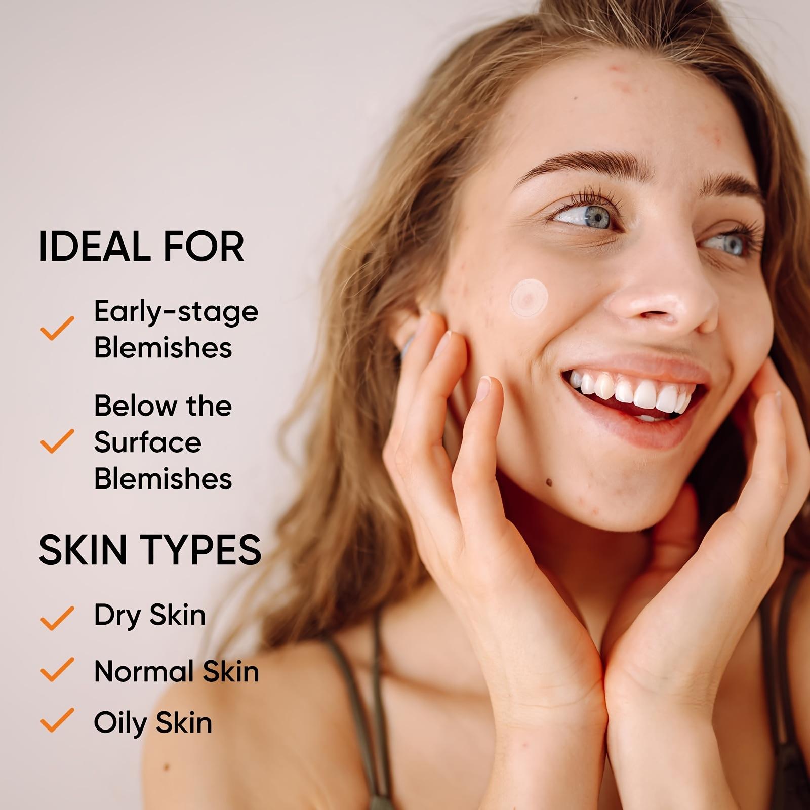 Patches de Hidrogel para Acne  - Xl Skincare avaliação e preço
