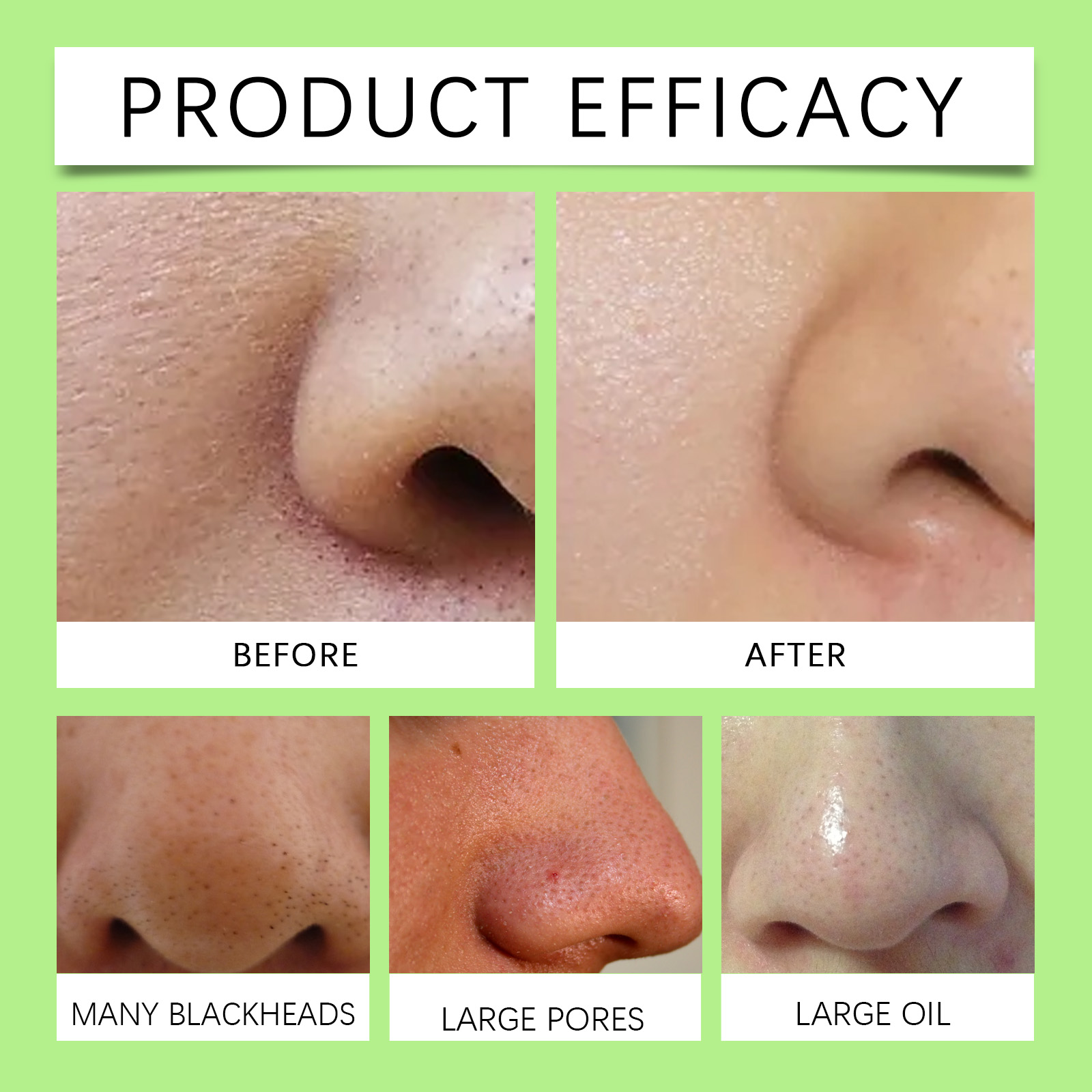 Tiras de Carvão de Bambu para  - Skincare Collagen avaliação e preço